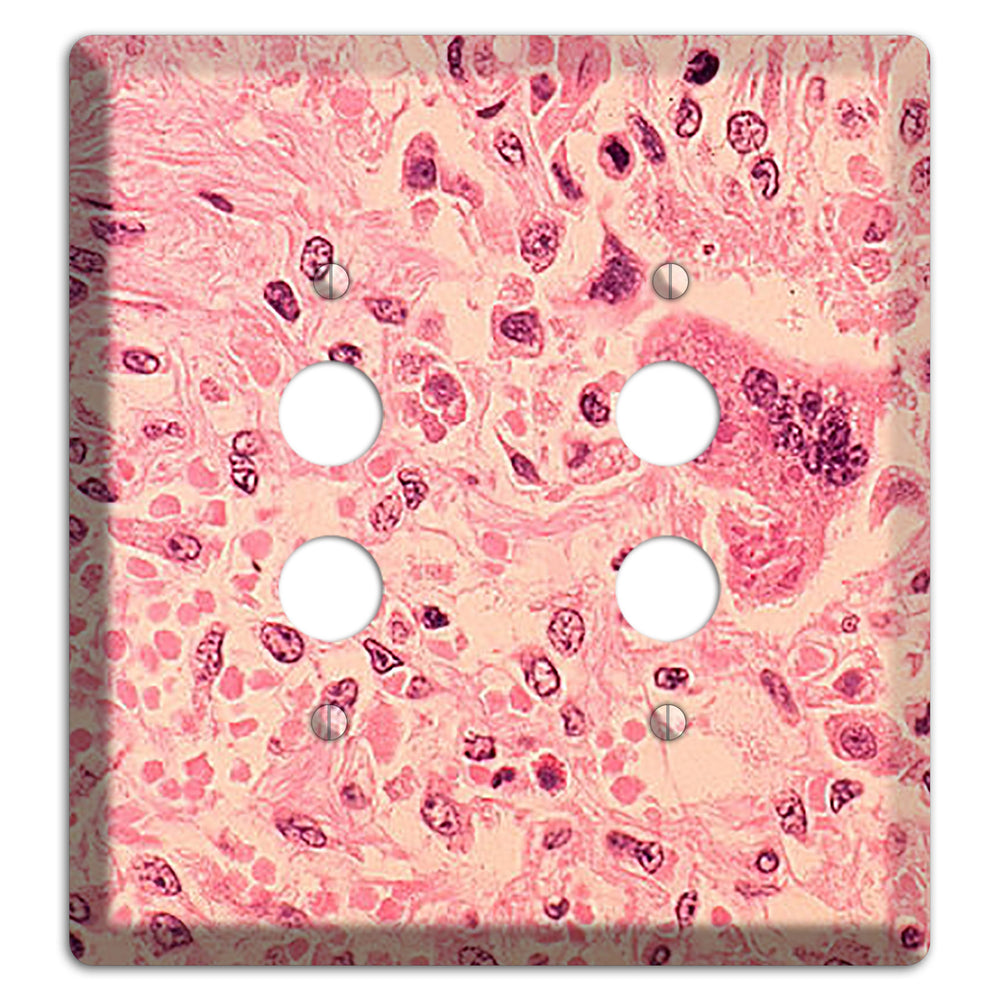 Measles Pneumonia 2 Pushbutton Wallplate