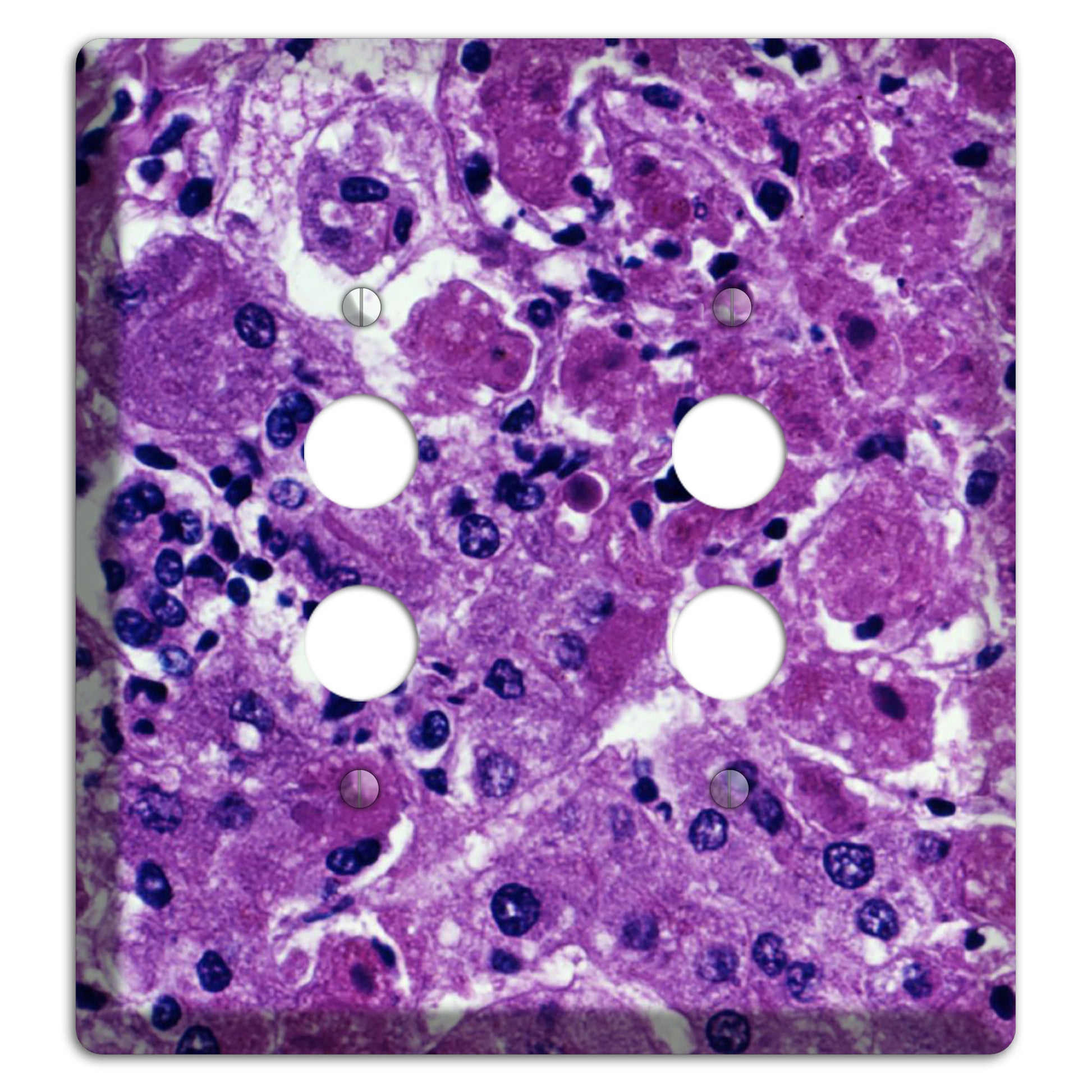 Marburg 2 Pushbutton Wallplate