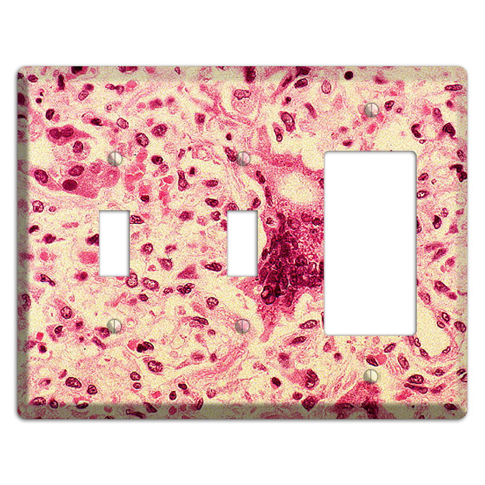 Morbillo 2 Toggle / Rocker Wallplate