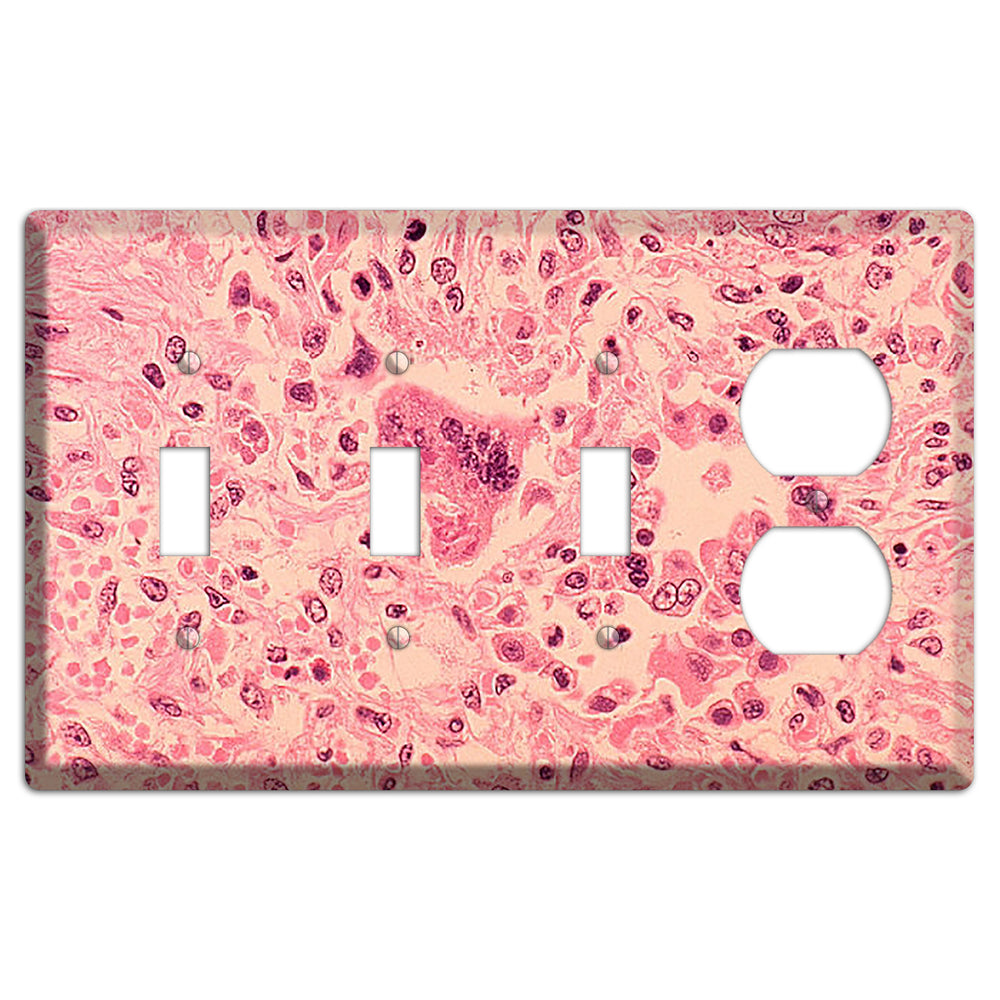 Measles Pneumonia 3 Toggle / Duplex Wallplate