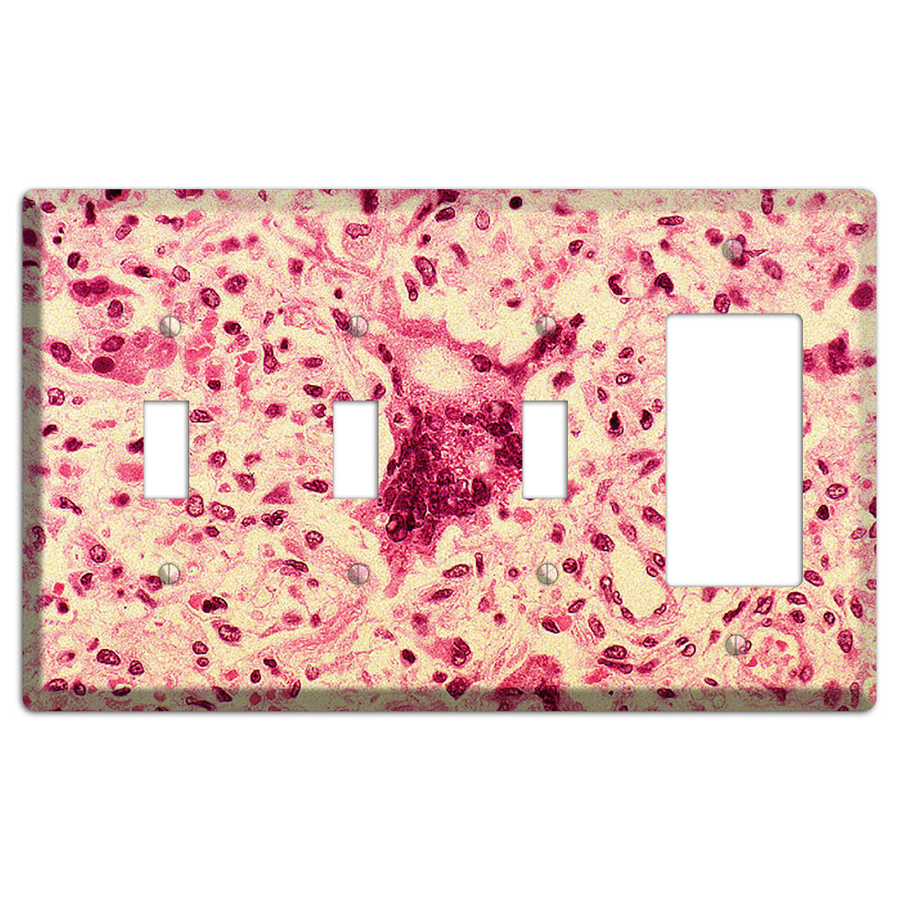Morbillo 3 Toggle / Rocker Wallplate