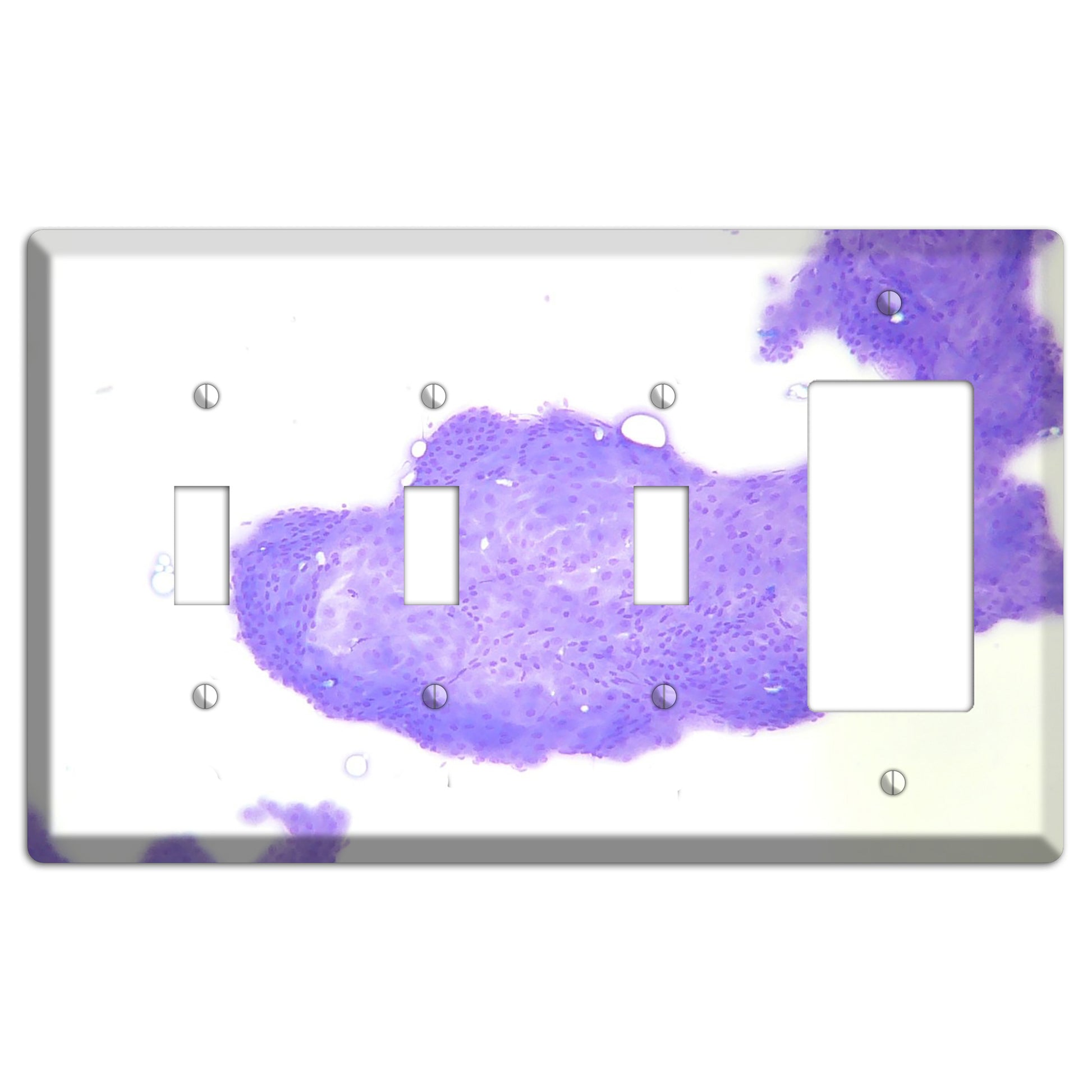 Perianal Gland Tumor Cytology 3 Toggle / Rocker Wallplate
