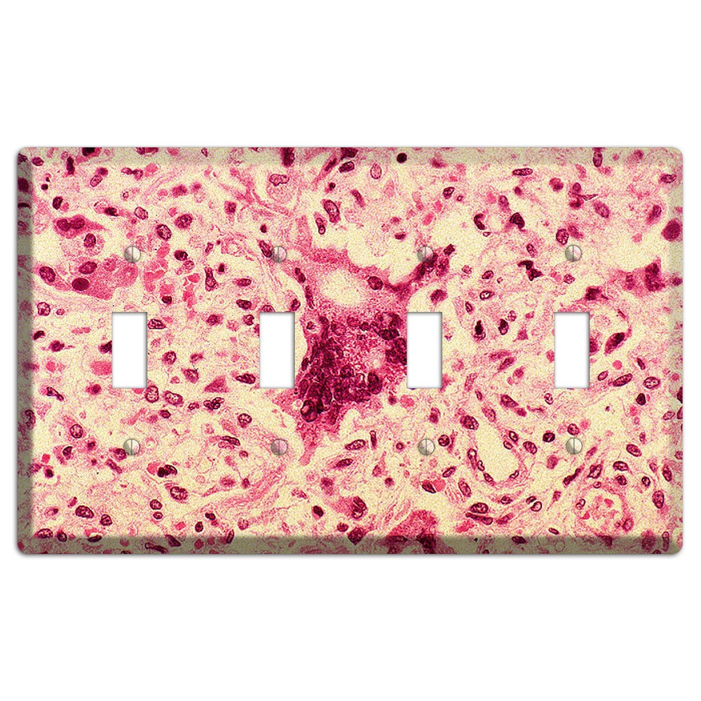 Morbillo 4 Toggle Wallplate