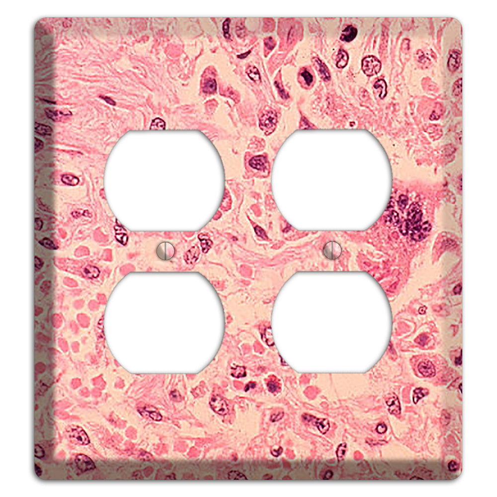 Measles Pneumonia 2 Duplex Wallplate