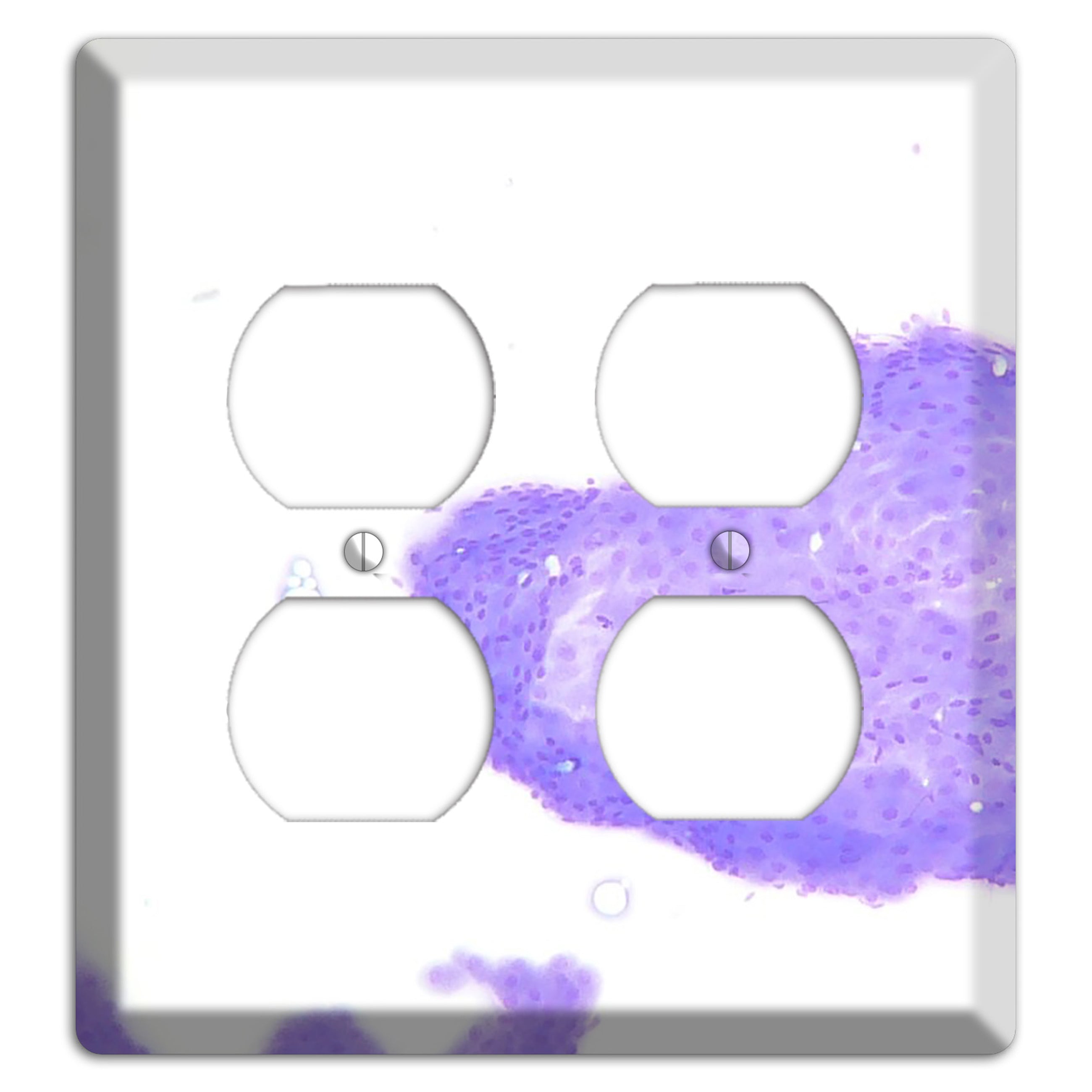 Perianal Gland Tumor Cytology 2 Duplex Wallplate