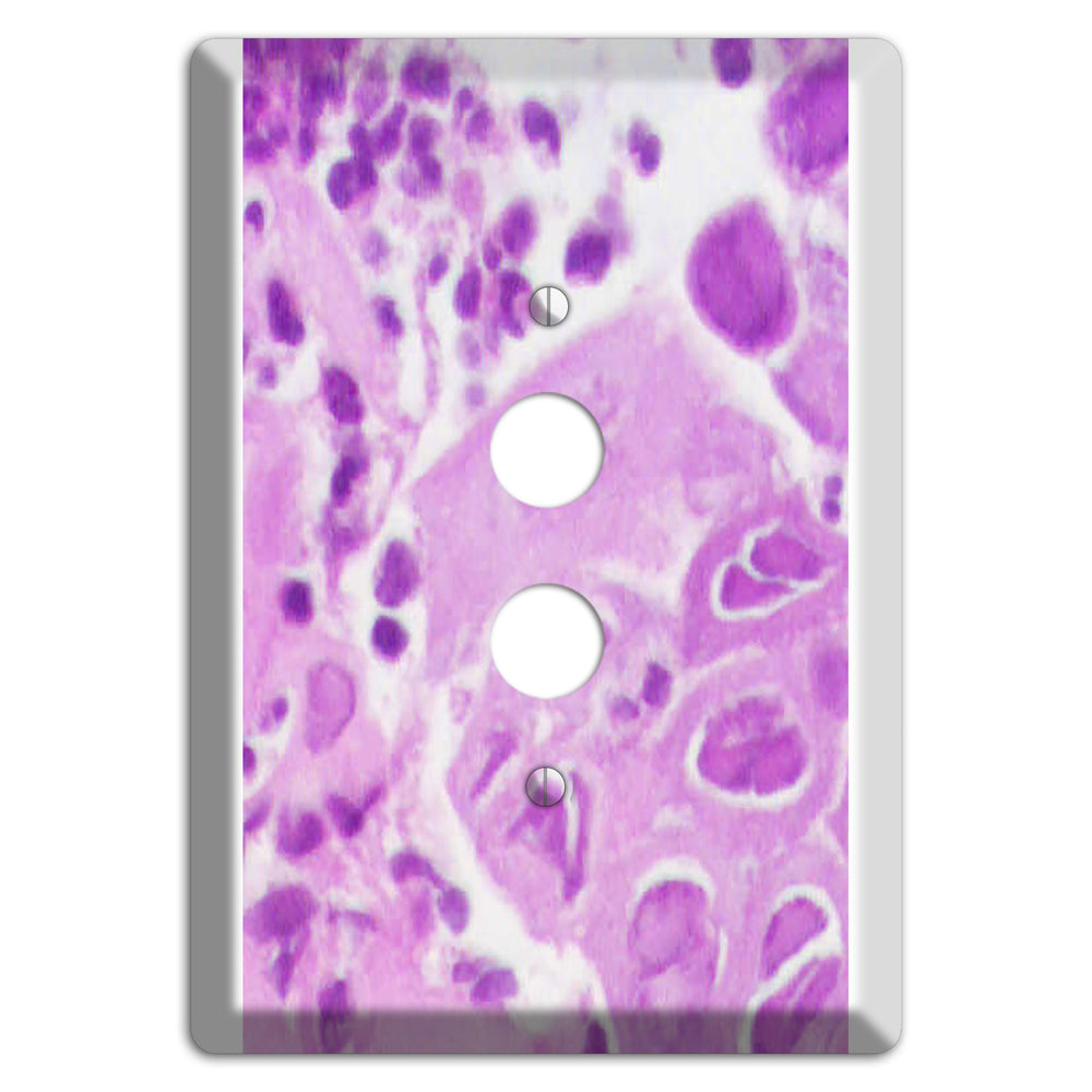 Esophagus Herpes 1 Pushbutton Wallplate