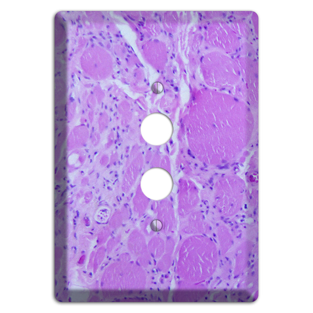 Poliovirus Myotonic Dystrophic 1 Pushbutton Wallplate