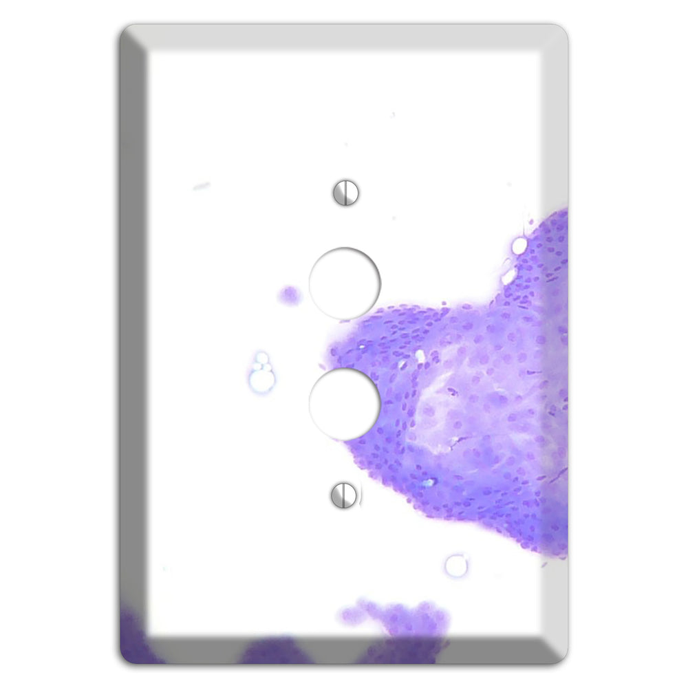 Perianal Gland Tumor Cytology 1 Pushbutton Wallplate