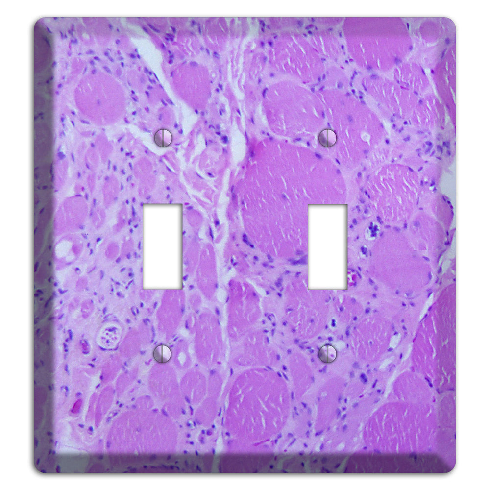 Poliovirus Myotonic Dystrophic 2 Toggle Wallplate