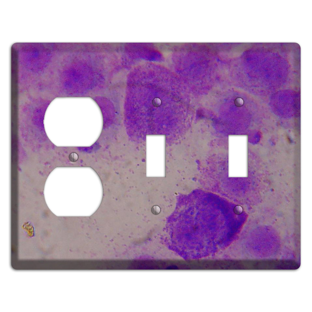 Mast Cell Tumor Duplex / 2 Toggle Wallplate