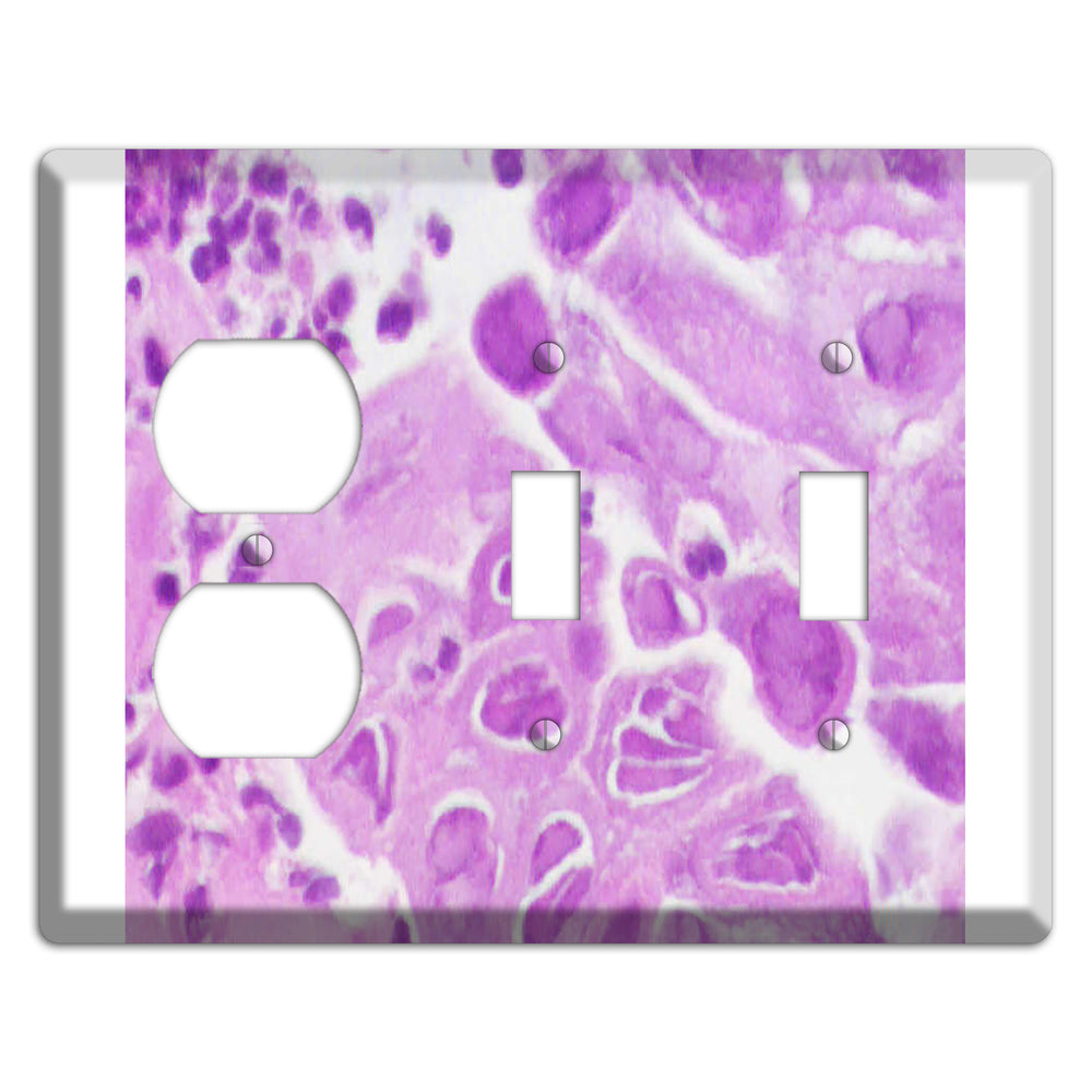 Esophagus Herpes Duplex / 2 Toggle Wallplate