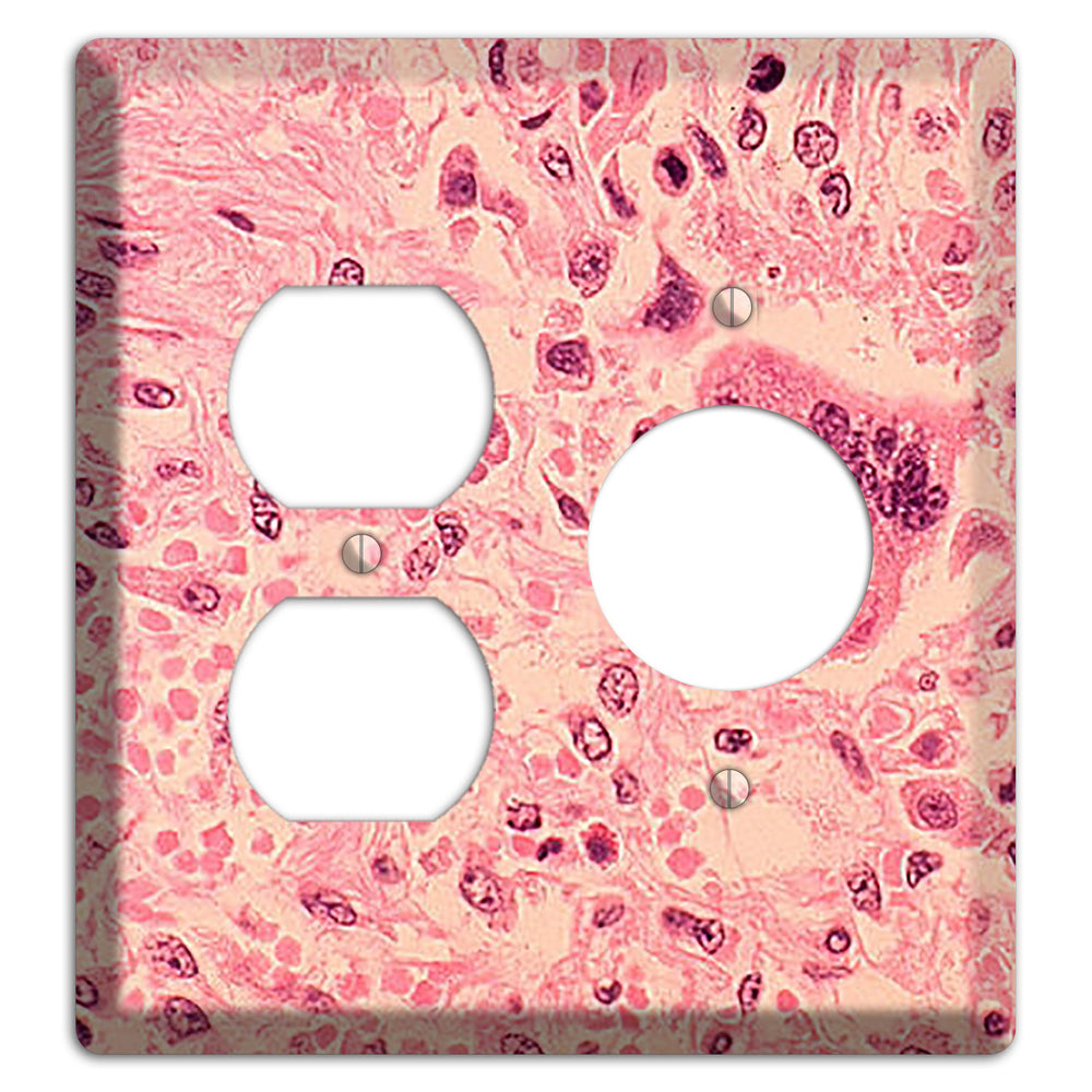 Measles Pneumonia Duplex / Receptacle Wallplate