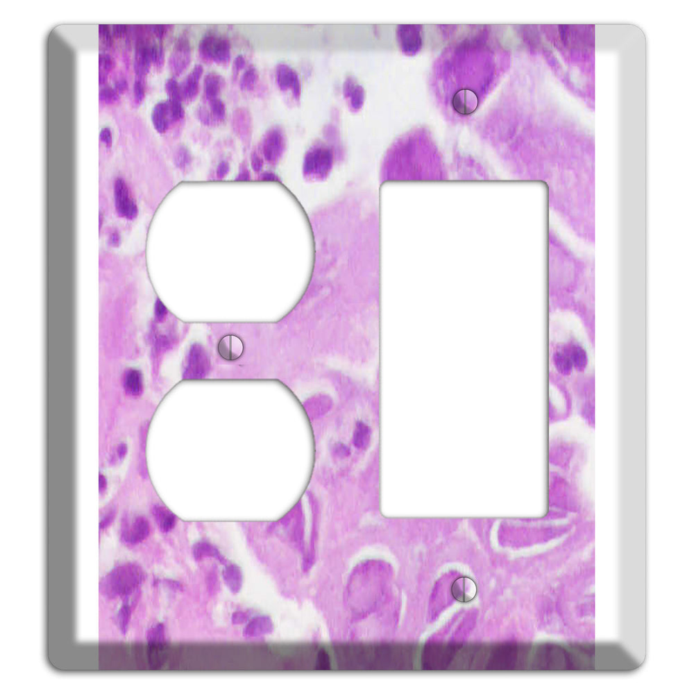 Esophagus Herpes Duplex / Rocker Wallplate