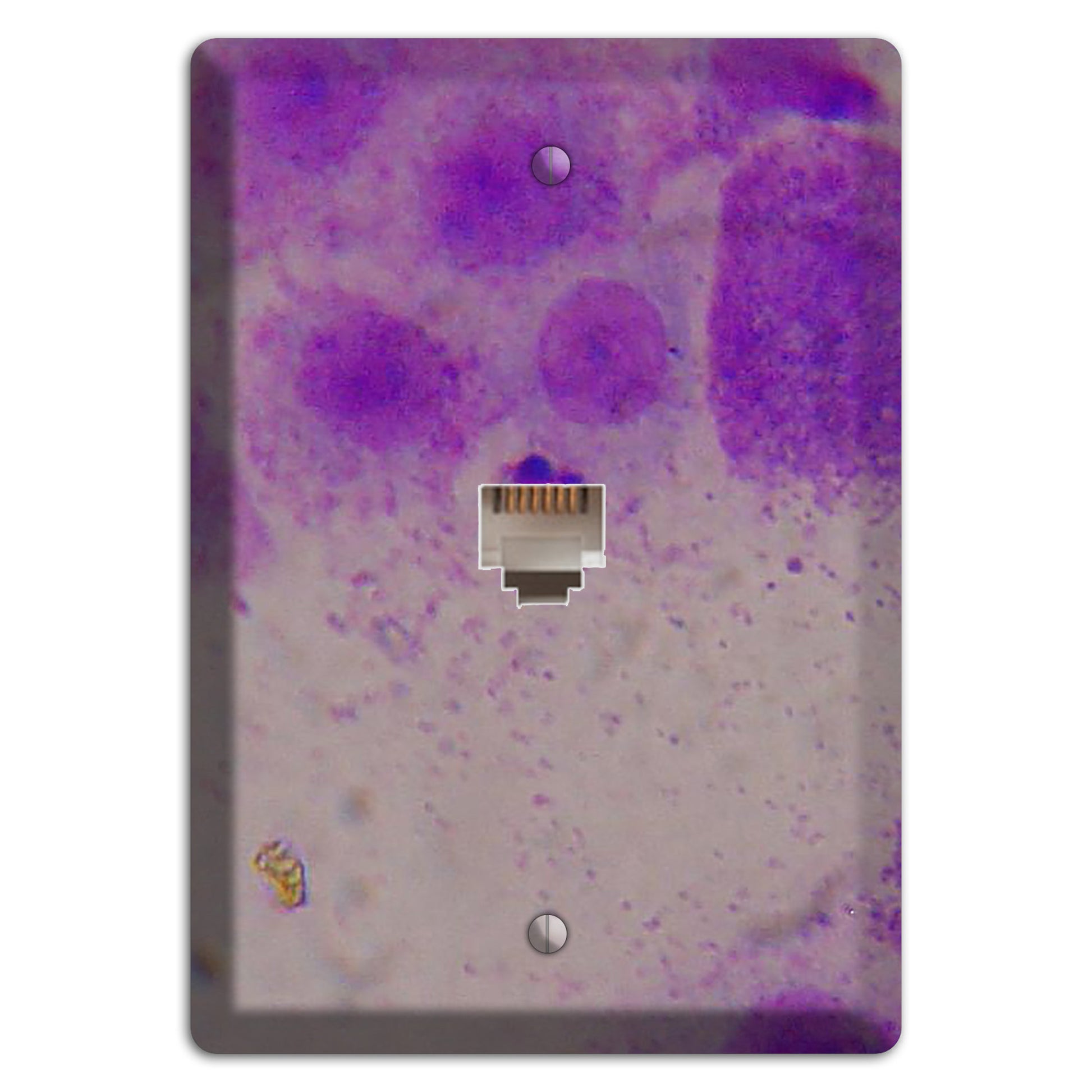 Mast Cell Tumor Phone Wallplate