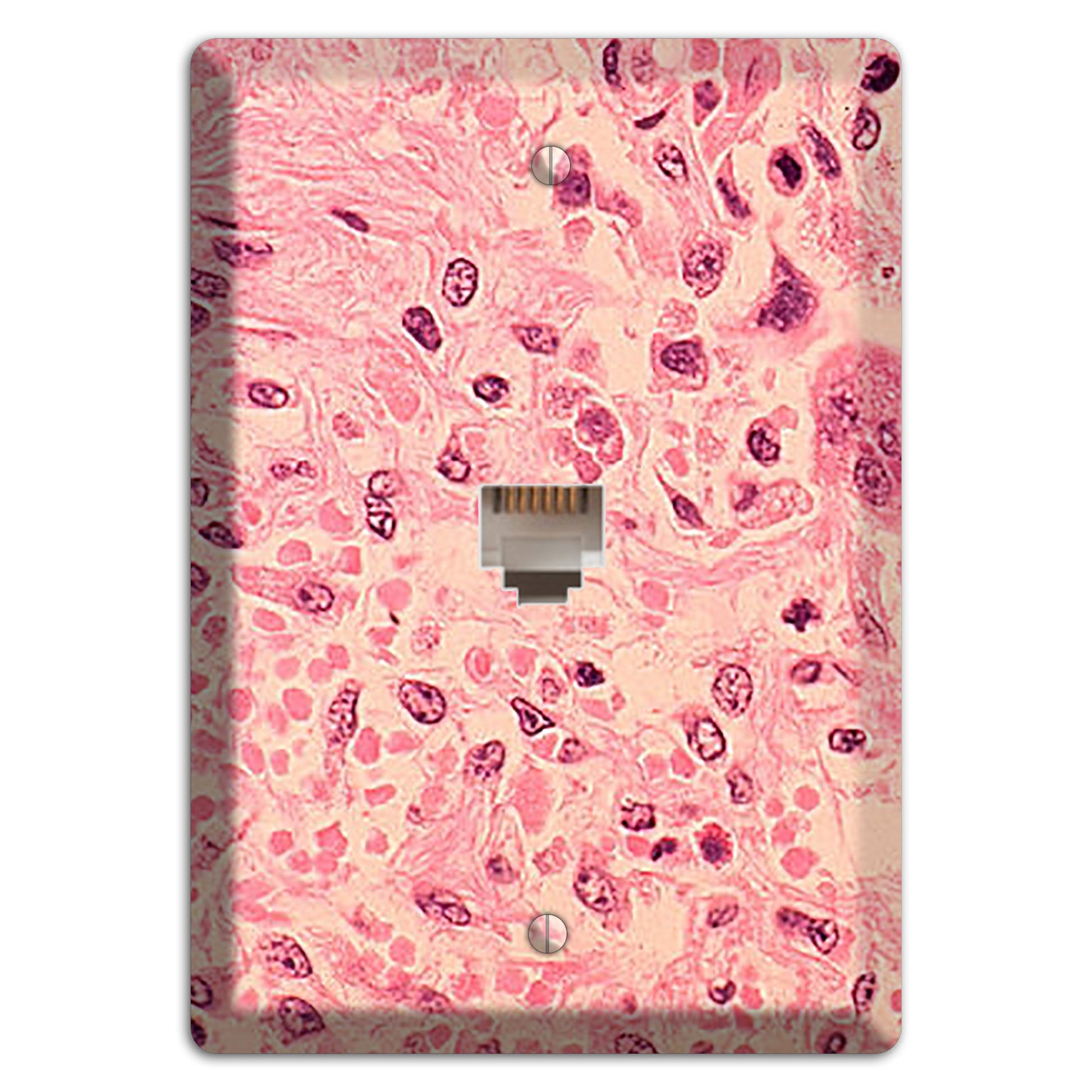 Measles Pneumonia Phone Wallplate