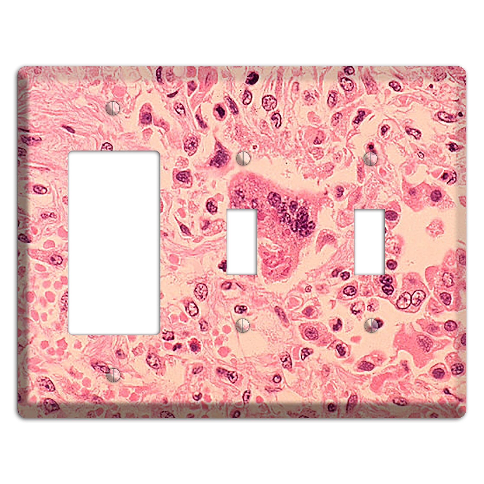 Measles Pneumonia Rocker / 2 Toggle Wallplate