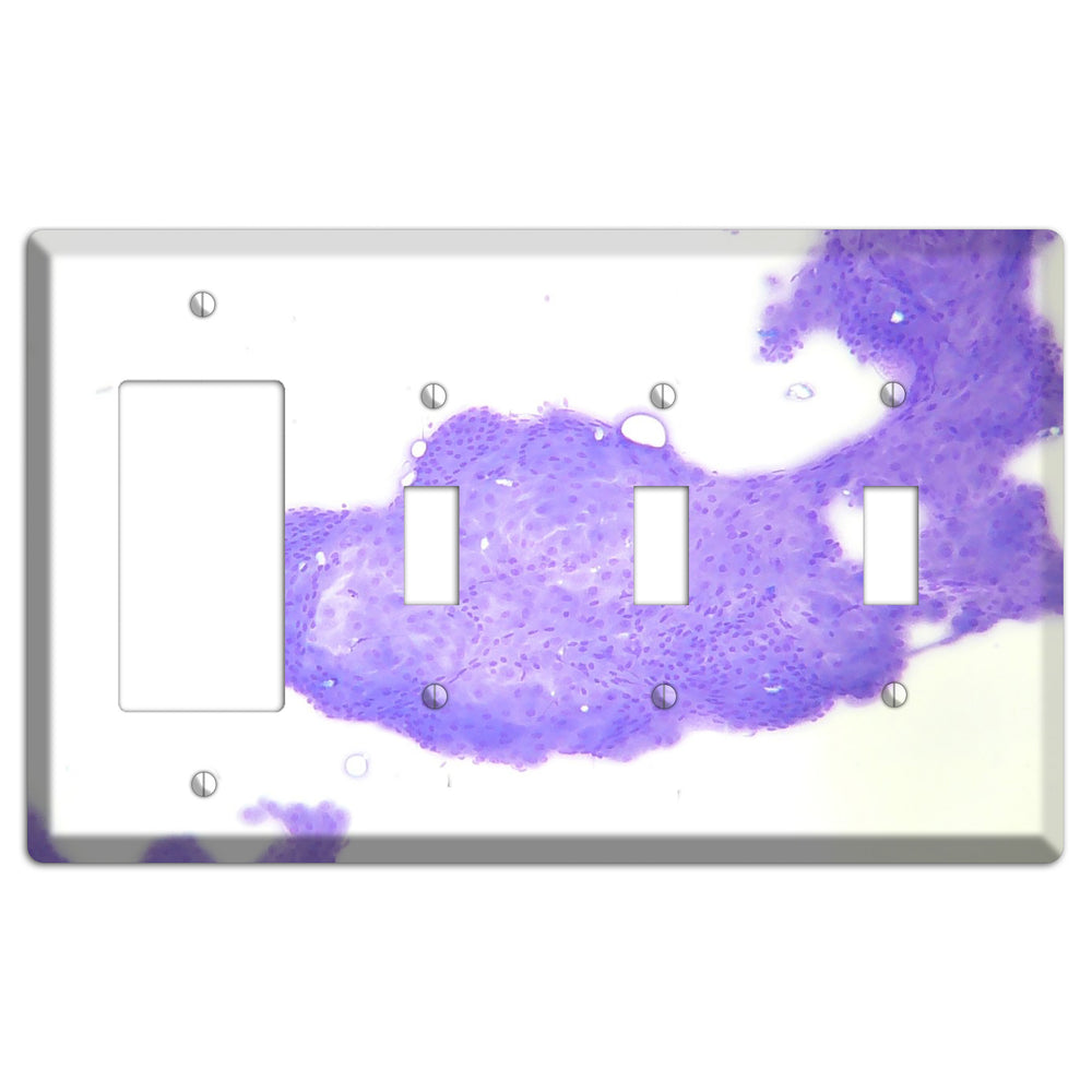 Perianal Gland Tumor Cytology Rocker / 3 Toggle Wallplate