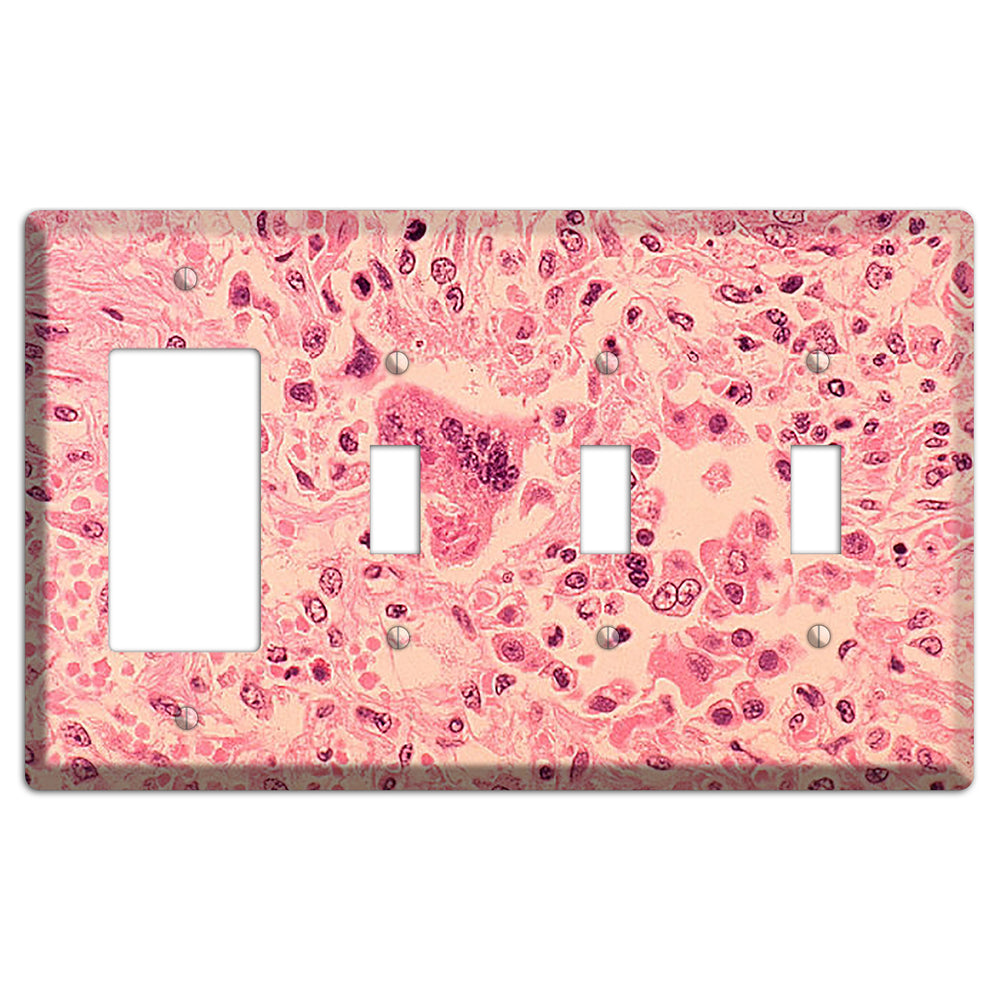Measles Pneumonia Rocker / 3 Toggle Wallplate