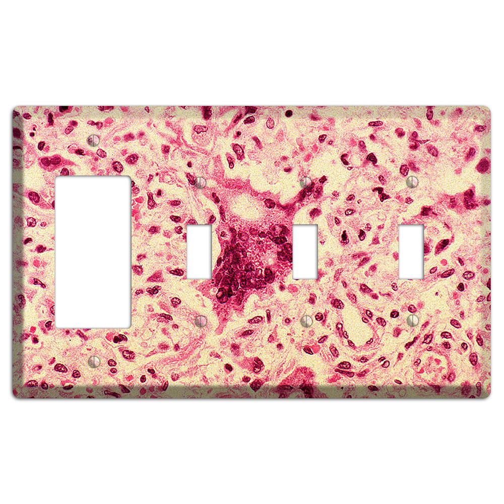 Morbillo Rocker / 3 Toggle Wallplate