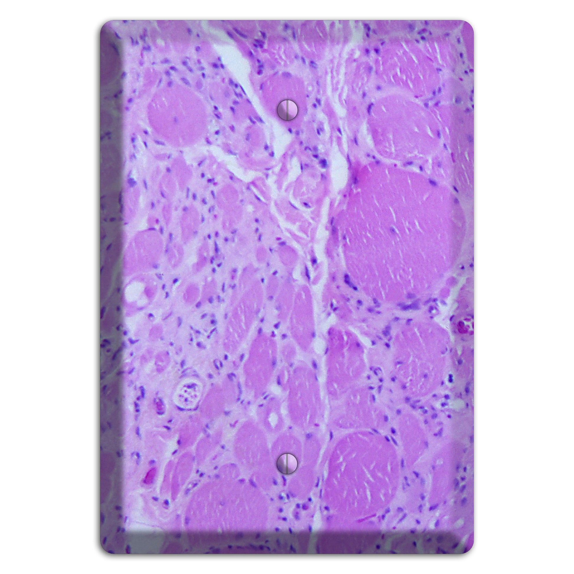 Poliovirus Myotonic Dystrophic Blank Wallplate