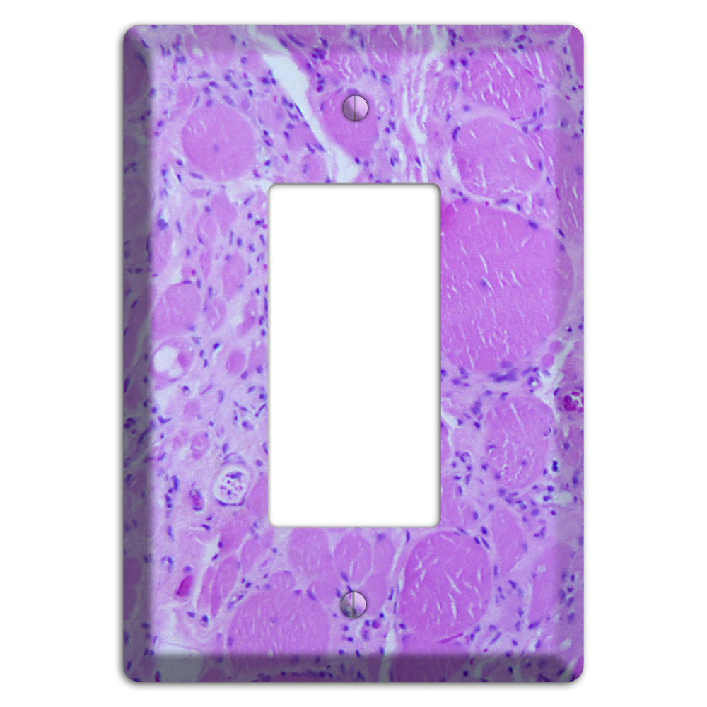 Poliovirus Myotonic Dystrophic Rocker Wallplate