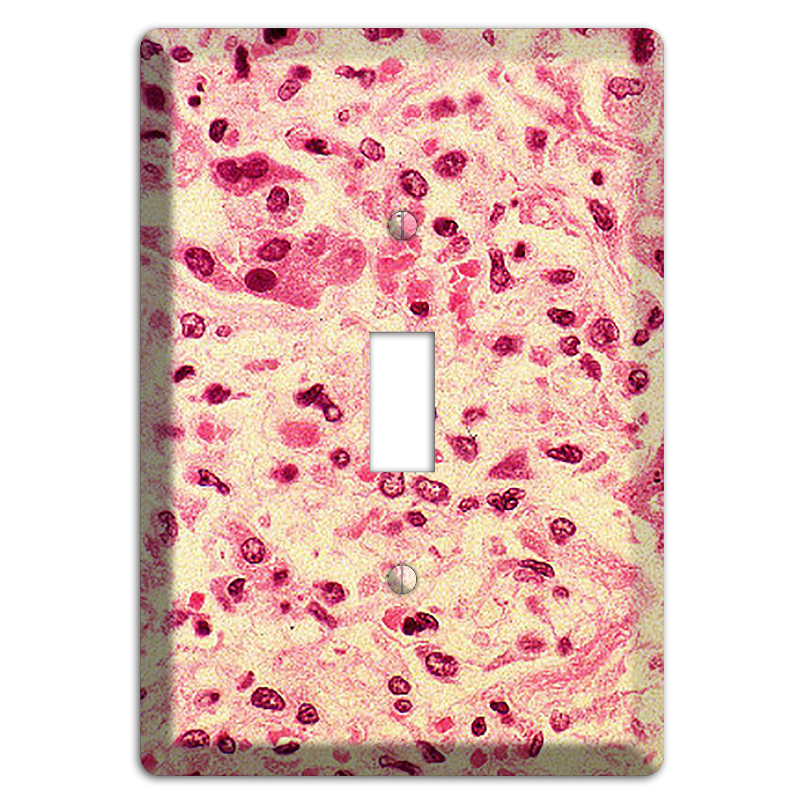 Morbillo Cover Plates