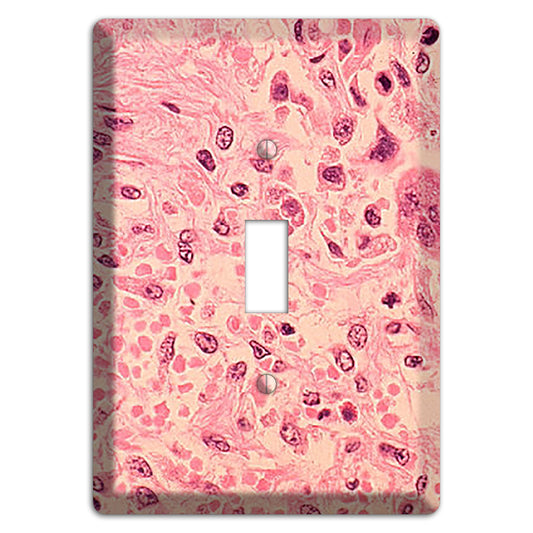 Measles Pneumonia Cover Plates