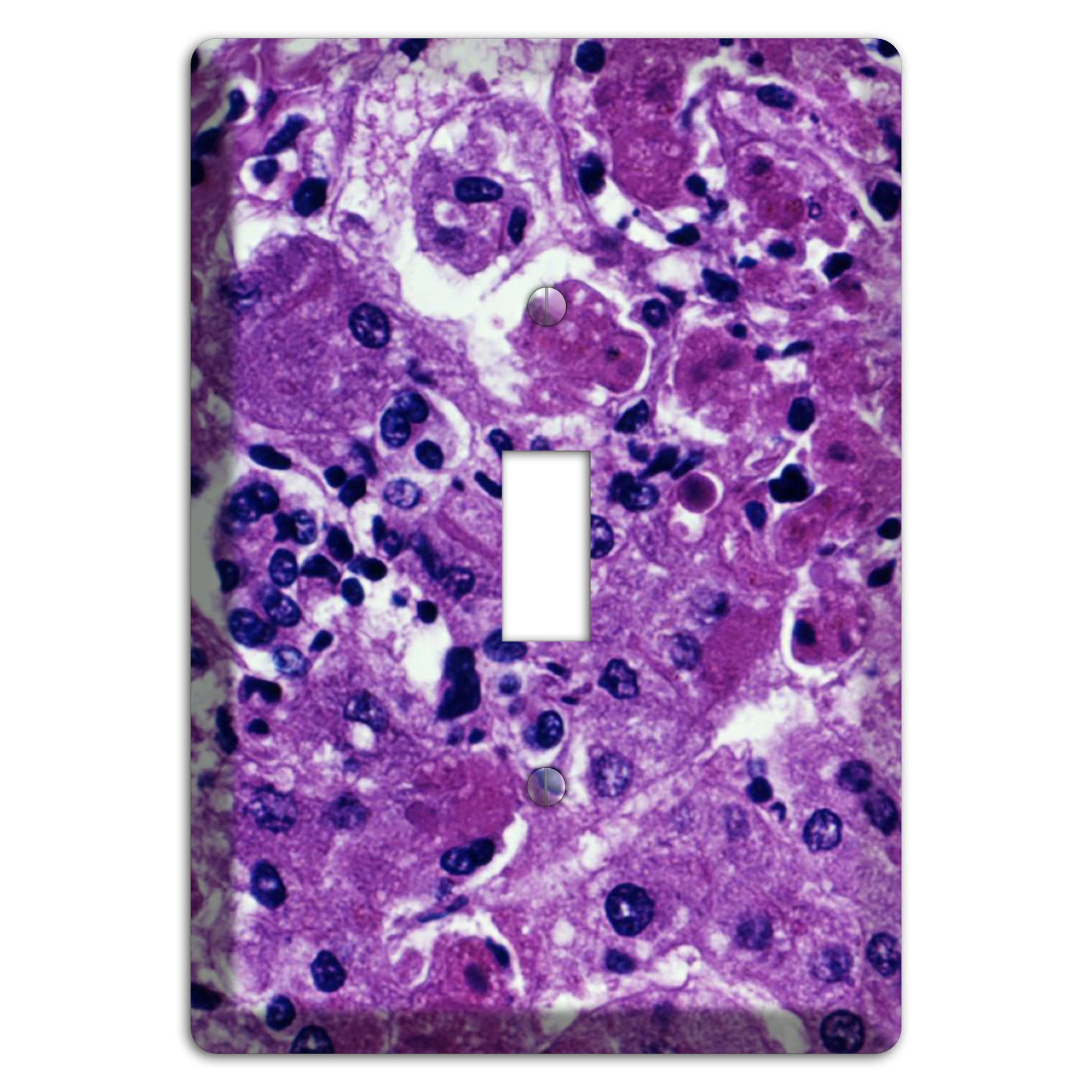 Marburg Cover Plates