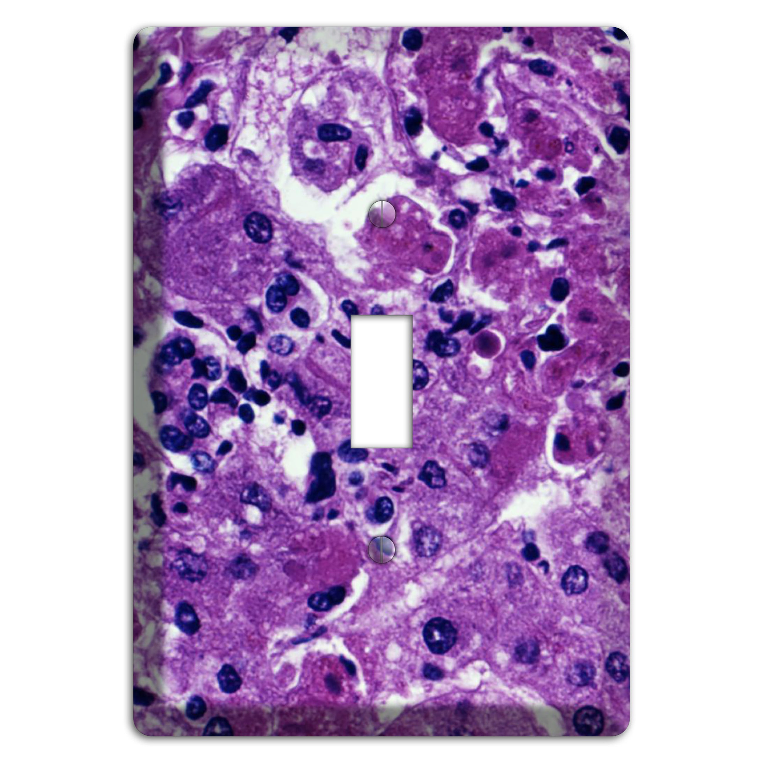 Marburg Cover Plates