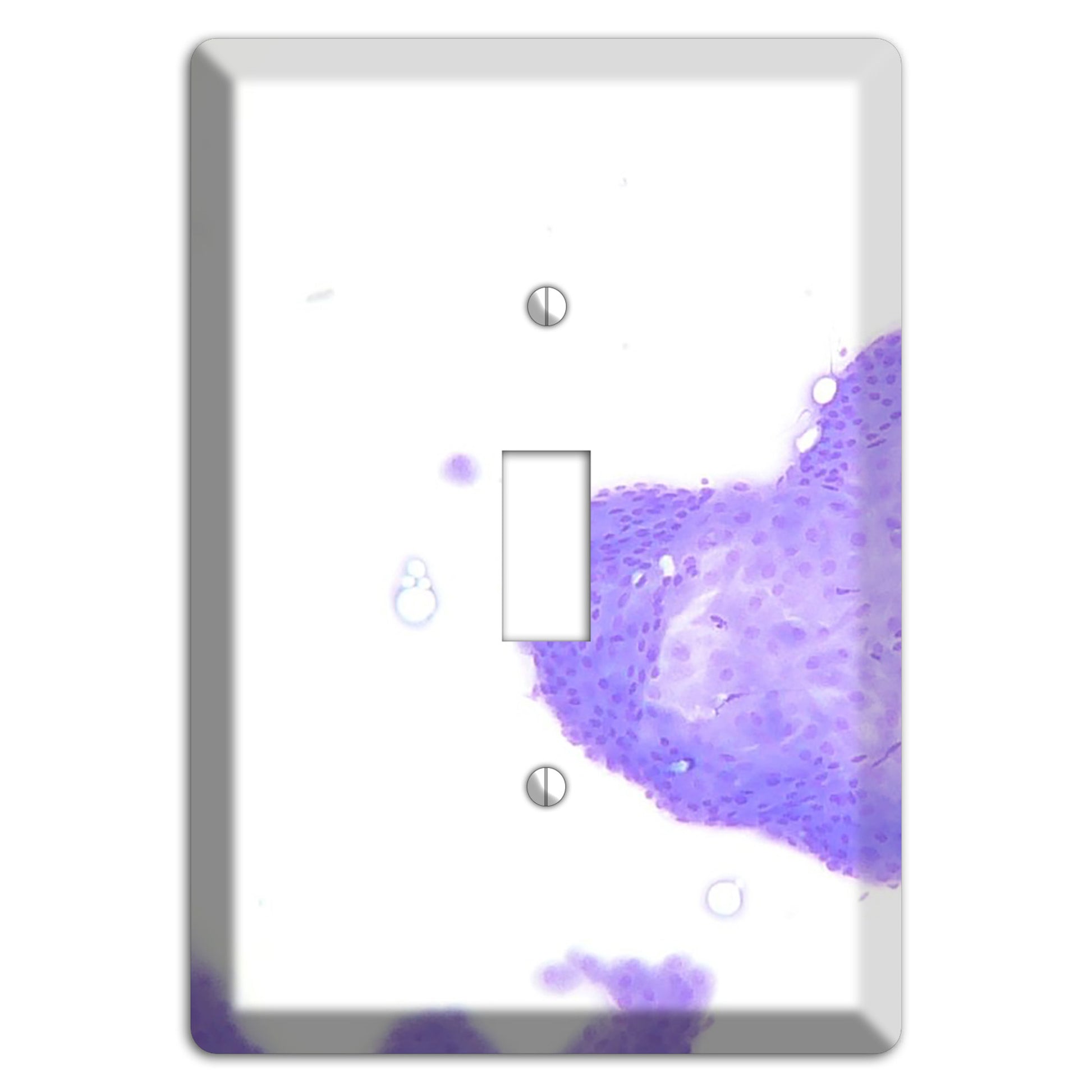 Perianal Gland Tumor Cytology Cover Plates