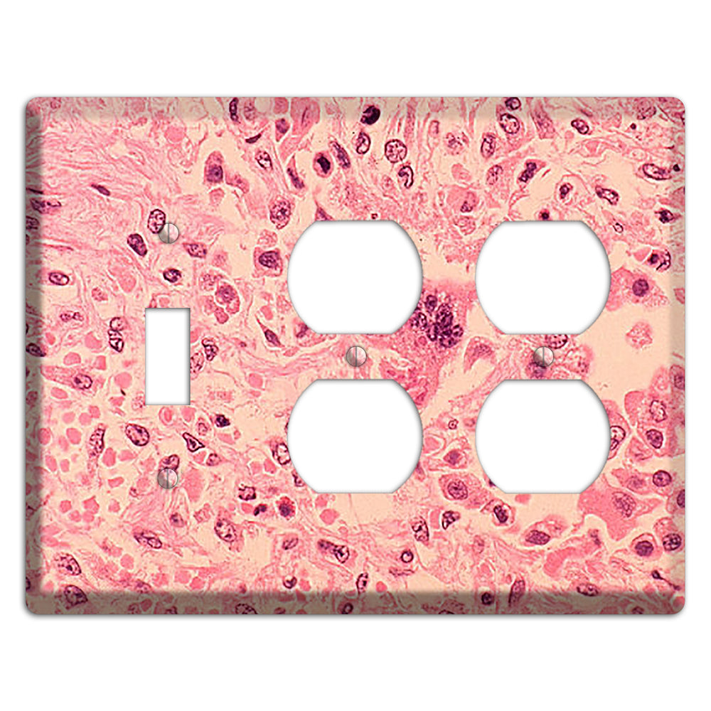 Measles Pneumonia Toggle / 2 Duplex Wallplate