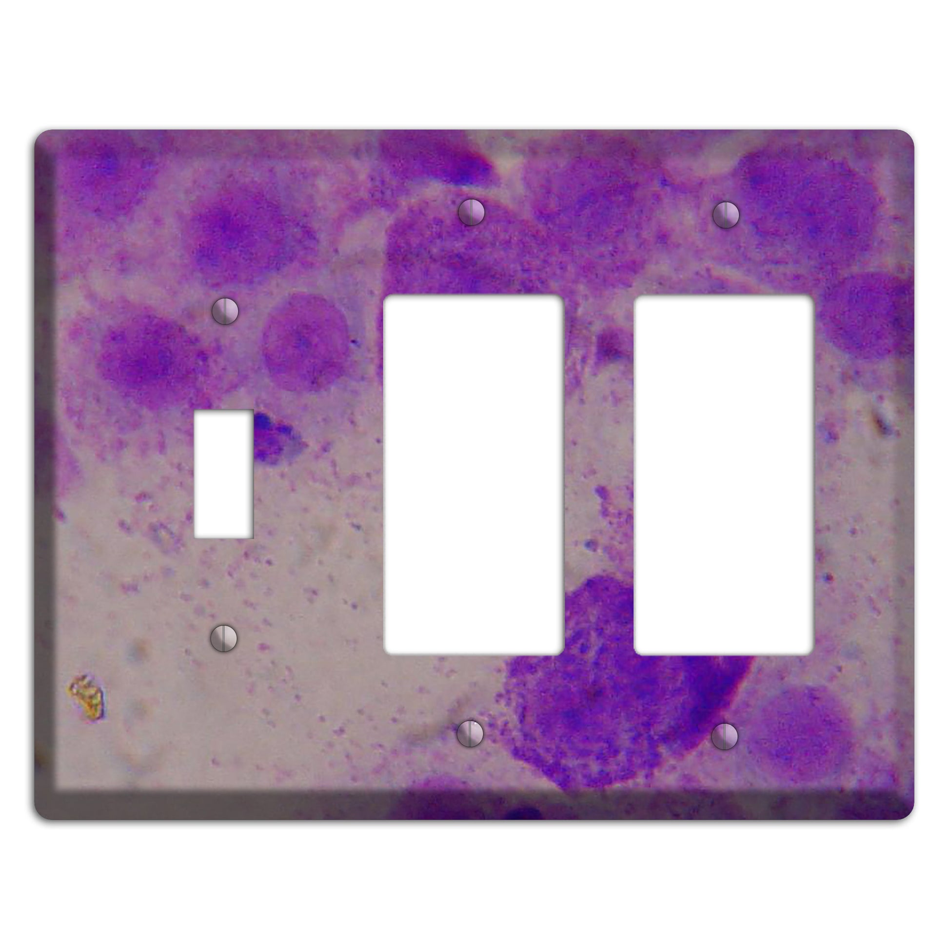 Mast Cell Tumor Toggle / 2 Rocker Wallplate