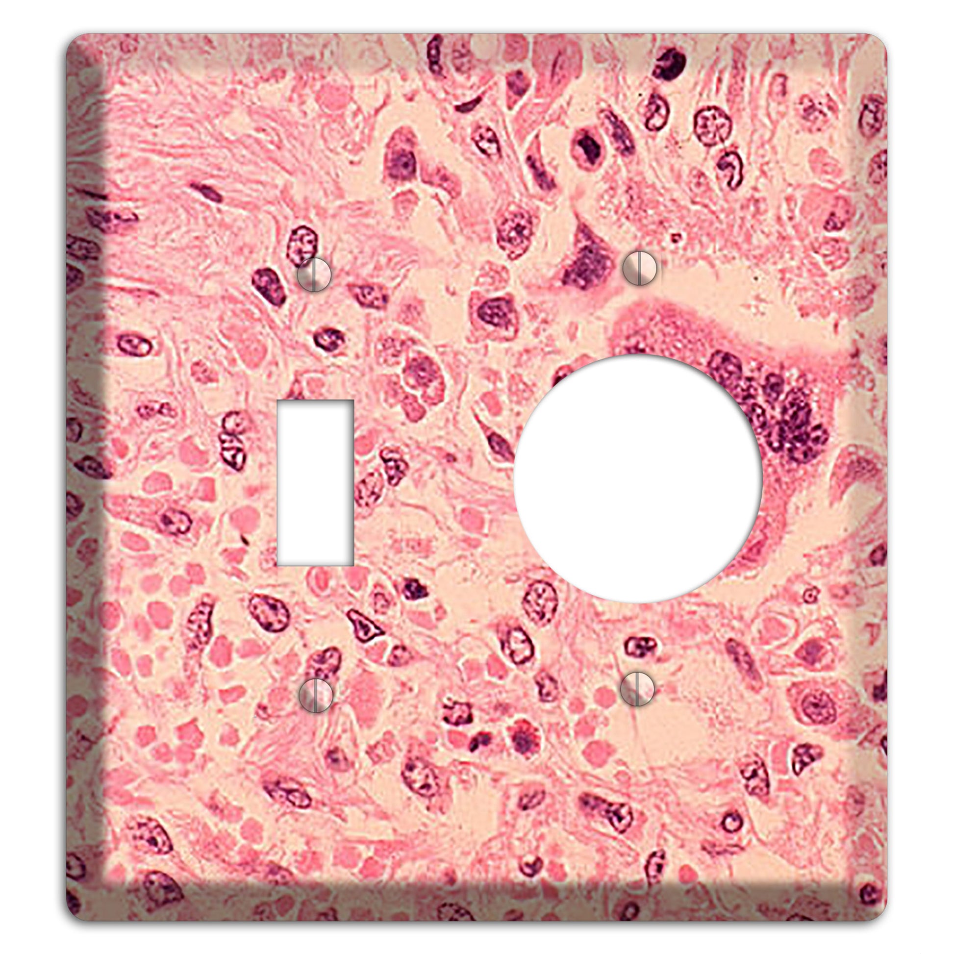 Measles Pneumonia Toggle / Receptacle Wallplate