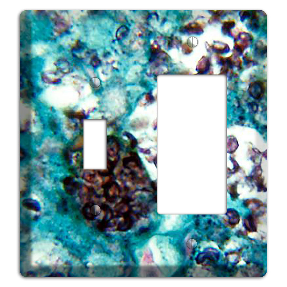 Histoplasmosis Capsulatum Toggle / Rocker Wallplate