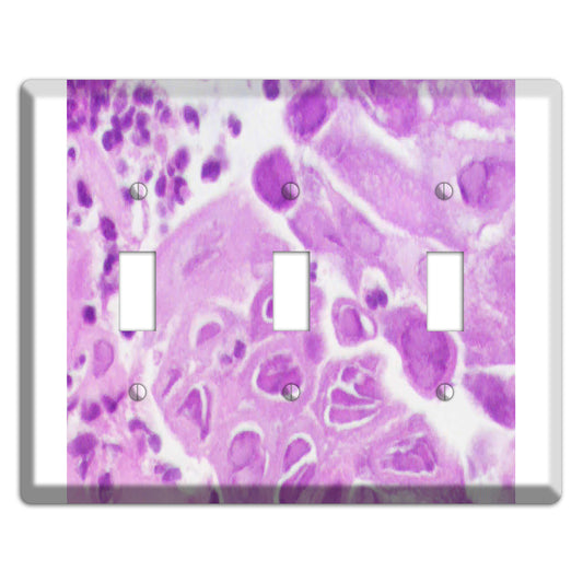 Esophagus Herpes 3 Toggle Wallplate
