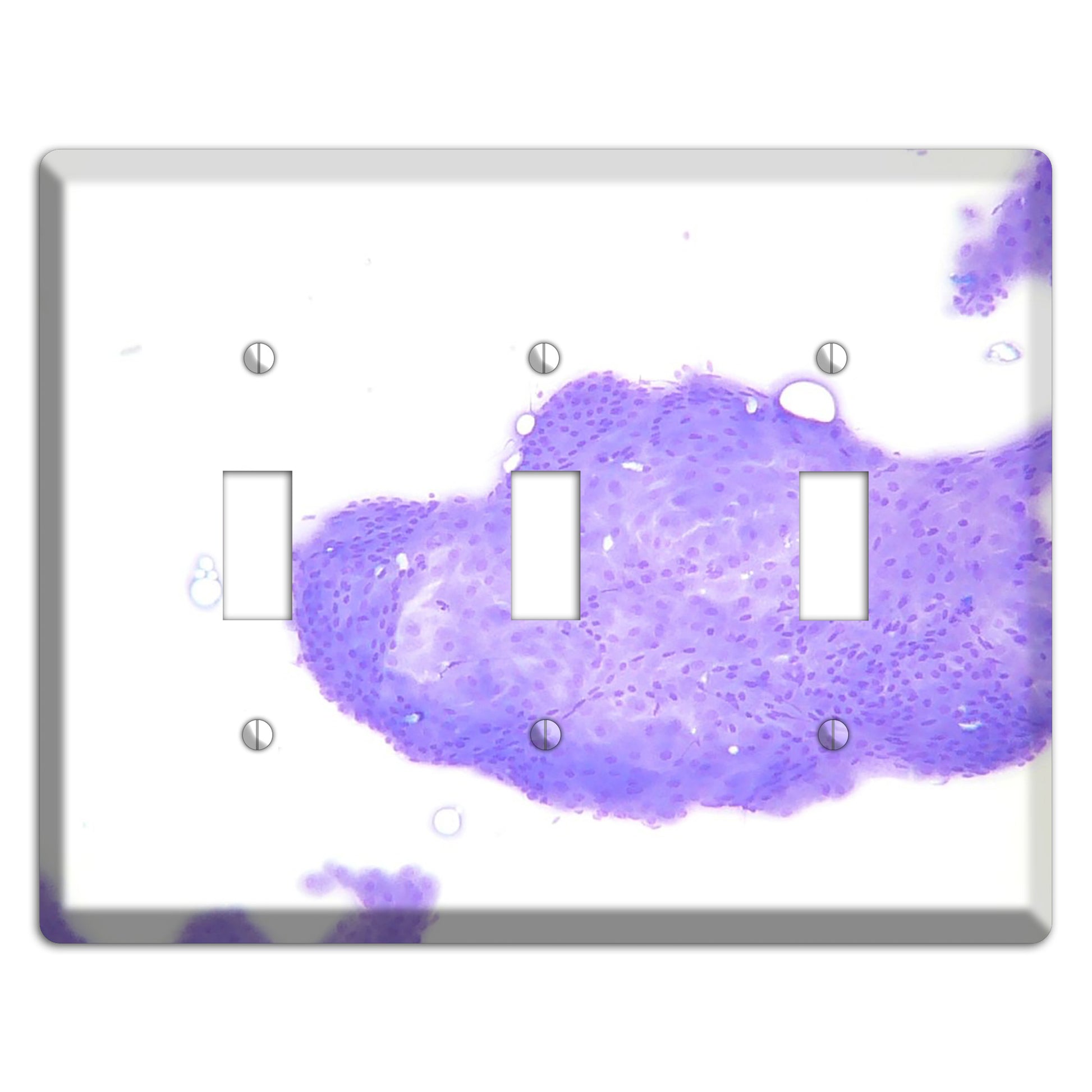 Perianal Gland Tumor Cytology 3 Toggle Wallplate